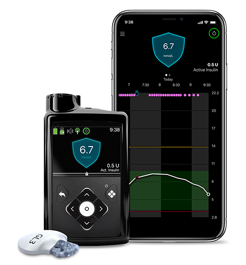 Access to CGM Changing Lives of Type 1 Diabetes Patients 